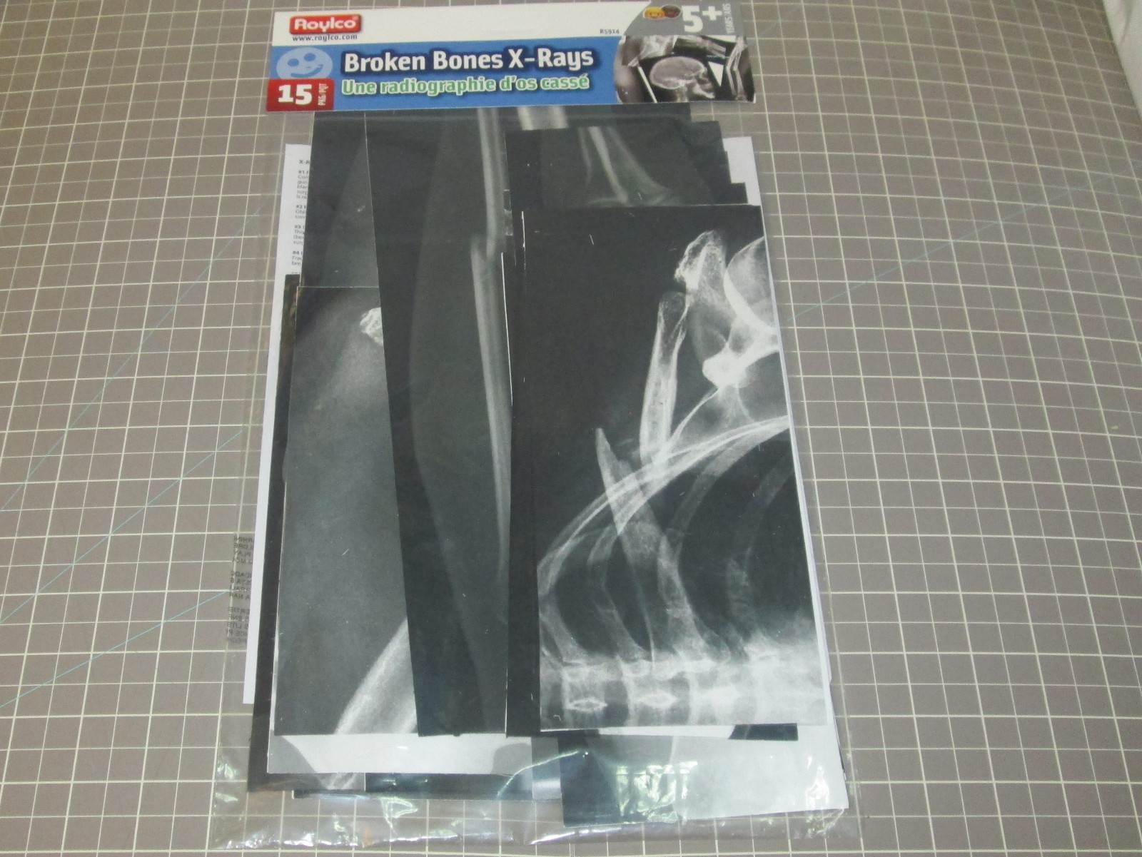 Roylco Inc. R-5914 Broken Bones X-Rays