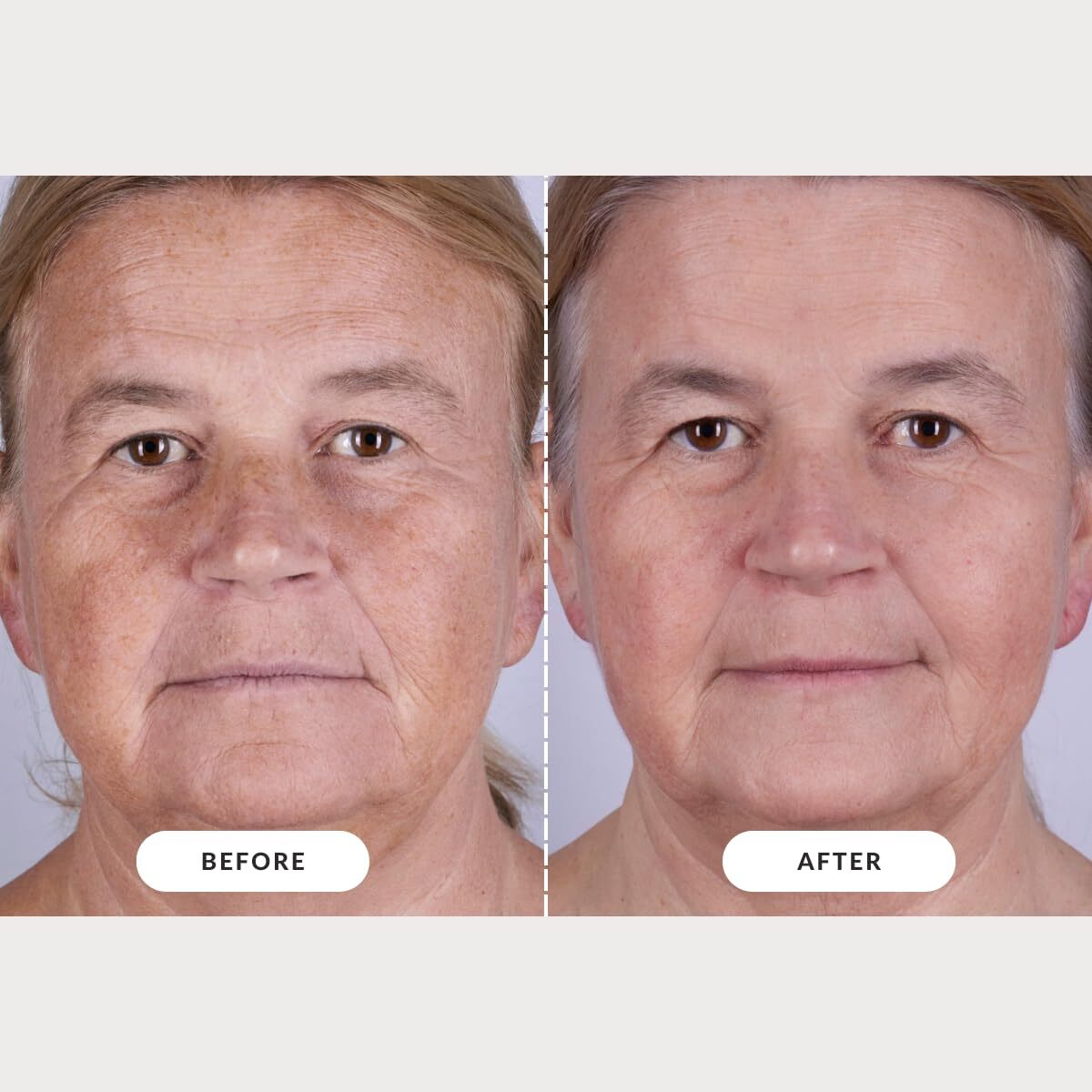 CurrentBody Skin LED Light Therapy Mask: Series 2